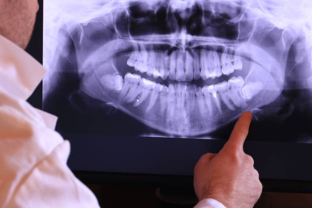 Best Broken or Chipped Tooth Repair in Cedar Hills, OR